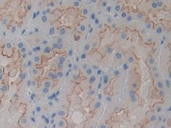 Invitrogen alpha Actinin 4 Polyclonal Antibody:Antibodies:Primary Antibodies