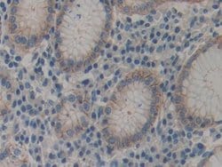 Invitrogen alpha Actinin 4 Polyclonal Antibody:Antibodies:Primary Antibodies