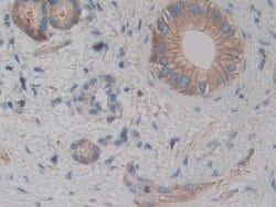 Invitrogen alpha Actinin 4 Polyclonal Antibody:Antibodies:Primary Antibodies