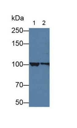 Invitrogen alpha Actinin 4 Polyclonal Antibody:Antibodies:Primary Antibodies