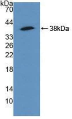 Invitrogen alpha Actinin 4 Polyclonal Antibody:Antibodies:Primary Antibodies