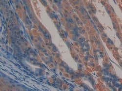 Invitrogen CD166 (ALCAM) Polyclonal Antibody 200 &mu;L; Unconjugated:Antibodies,