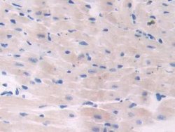 Invitrogen ADCY6 Polyclonal Antibody:Antibodies:Primary Antibodies