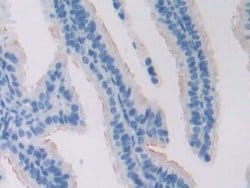 Invitrogen ADCY6 Polyclonal Antibody:Antibodies:Primary Antibodies