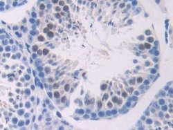 Invitrogen ADCY6 Polyclonal Antibody:Antibodies:Primary Antibodies
