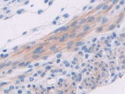 Invitrogen ADCY6 Polyclonal Antibody:Antibodies:Primary Antibodies