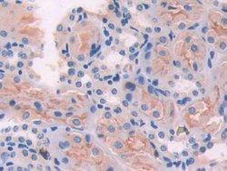 Invitrogen ADCY6 Polyclonal Antibody:Antibodies:Primary Antibodies