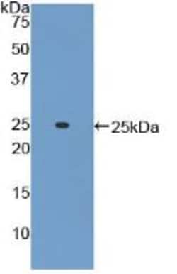 Invitrogen ADCY6 Polyclonal Antibody:Antibodies:Primary Antibodies