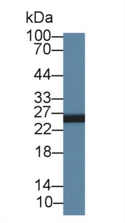 Invitrogen AK3 Polyclonal Antibody 200 &mu;L; Unconjugated:Antibodies,