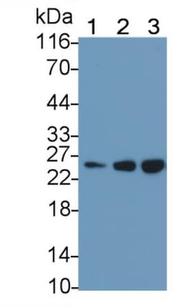 Invitrogen AK3 Polyclonal Antibody:Antibodies:Primary Antibodies