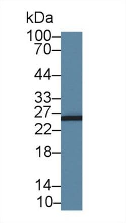 Invitrogen AK3 Polyclonal Antibody 200 &mu;L; Unconjugated:Antibodies,