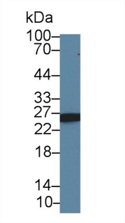 Invitrogen AK3 Polyclonal Antibody:Antibodies:Primary Antibodies