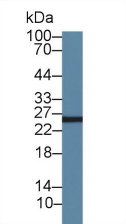 Invitrogen AK3 Polyclonal Antibody 200 &mu;L; Unconjugated:Antibodies,