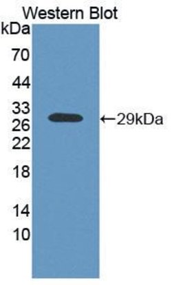 Invitrogen AK3 Polyclonal Antibody 200 &mu;L; Unconjugated:Antibodies,