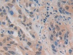 Invitrogen ADRM1 Polyclonal Antibody:Antibodies:Primary Antibodies
