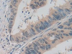 Invitrogen ADRM1 Polyclonal Antibody:Antibodies:Primary Antibodies