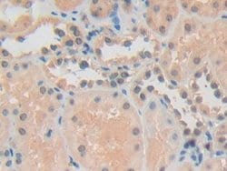 Invitrogen ADRM1 Polyclonal Antibody:Antibodies:Primary Antibodies