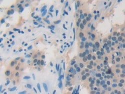Invitrogen ADRM1 Polyclonal Antibody:Antibodies:Primary Antibodies