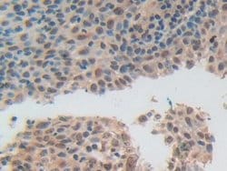 Invitrogen ADRM1 Polyclonal Antibody:Antibodies:Primary Antibodies