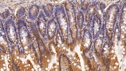 Invitrogen ADRM1 Polyclonal Antibody 20 &mu;L; Unconjugated:Antibodies,