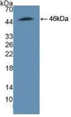 Invitrogen ADRM1 Polyclonal Antibody:Antibodies:Primary Antibodies