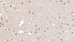 Invitrogen AgRP Polyclonal Antibody:Antibodies:Primary Antibodies