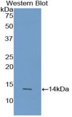 Invitrogen AgRP Polyclonal Antibody:Antibodies:Primary Antibodies