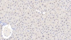 Invitrogen Alcohol Dehydrogenase 1A Polyclonal Antibody:Antibodies:Primary