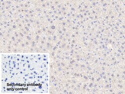 Invitrogen Alcohol Dehydrogenase 1A Polyclonal Antibody:Antibodies:Primary