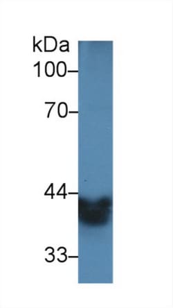 Invitrogen Alcohol Dehydrogenase 1A Polyclonal Antibody:Antibodies:Primary