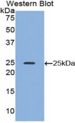 Invitrogen Alcohol Dehydrogenase 1A Polyclonal Antibody:Antibodies:Primary
