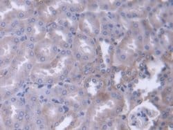 Invitrogen alpha Adducin Polyclonal Antibody:Antibodies:Primary Antibodies