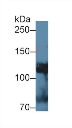 Invitrogen alpha Adducin Polyclonal Antibody:Antibodies:Primary Antibodies