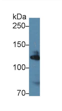 Invitrogen alpha Adducin Polyclonal Antibody:Antibodies:Primary Antibodies