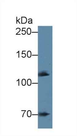 Invitrogen alpha Adducin Polyclonal Antibody:Antibodies:Primary Antibodies