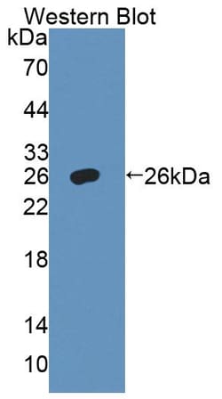 Invitrogen alpha Adducin Polyclonal Antibody:Antibodies:Primary Antibodies