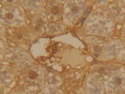 Invitrogen alpha-1 Antitrypsin Polyclonal Antibody:Antibodies:Primary Antibodies