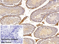Invitrogen alpha-1 Antitrypsin Polyclonal Antibody 20 &mu;L | Buy Online | Invitrogen&trade; | Fisher Scientific