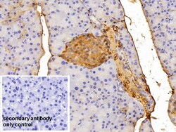 Invitrogen alpha-1 Antitrypsin Polyclonal Antibody 20 &mu;L | Buy Online | Invitrogen&trade; | Fisher Scientific