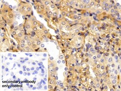 Invitrogen alpha-1 Antitrypsin Polyclonal Antibody 20 &mu;L | Buy Online | Invitrogen&trade; | Fisher Scientific