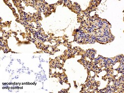 Invitrogen alpha-1 Antitrypsin Polyclonal Antibody 20 &mu;L | Buy Online | Invitrogen&trade; | Fisher Scientific