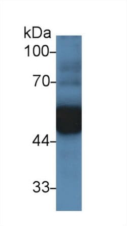 Invitrogen alpha-1 Antitrypsin Polyclonal Antibody:Antibodies:Primary Antibodies
