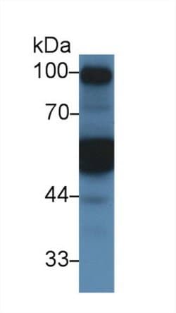 Invitrogen alpha-1 Antitrypsin Polyclonal Antibody:Antibodies:Primary Antibodies
