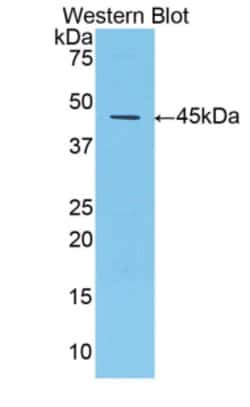 Invitrogen alpha-1 Antitrypsin Polyclonal Antibody:Antibodies:Primary Antibodies