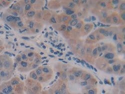 Invitrogen AFP Polyclonal Antibody 20 &mu;L; Unconjugated:Antibodies, Polyclonal