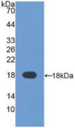 Invitrogen AFP Polyclonal Antibody 20 &mu;L; Unconjugated:Antibodies, Polyclonal