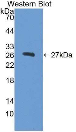 Invitrogen AFP Polyclonal Antibody:Antibodies:Primary Antibodies