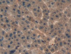 Invitrogen AHSP Polyclonal Antibody 20 &mu;L; Unconjugated:Antibodies,