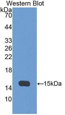 Invitrogen AHSP Polyclonal Antibody 20 &mu;L; Unconjugated:Antibodies,