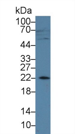 Invitrogen AMELX Polyclonal Antibody:Antibodies:Primary Antibodies